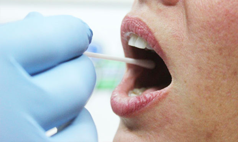 Il Test Genetico per l'intolleranza al lattosio
